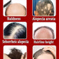 If you are suffering from hair loss and baldness, don’t miss this product.
