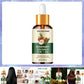 Rosemary Oil Hair Essential Coconut Oil Improve Hair Loss And Nourishes Strengthen Hair Roots Scalp Treatment Hair Care