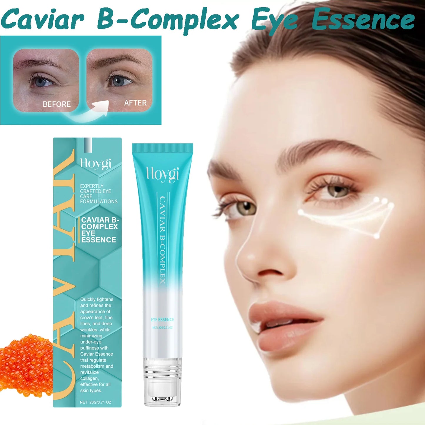 Caviar B-Complex Eye Essence Remove Dark Clrcles Anti Puffiness Smoothing Fine Lines Moisturize Skin Around the Eye Serum