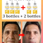 NO Wrinkle, 20 years younger.full body face.More discounts on packages