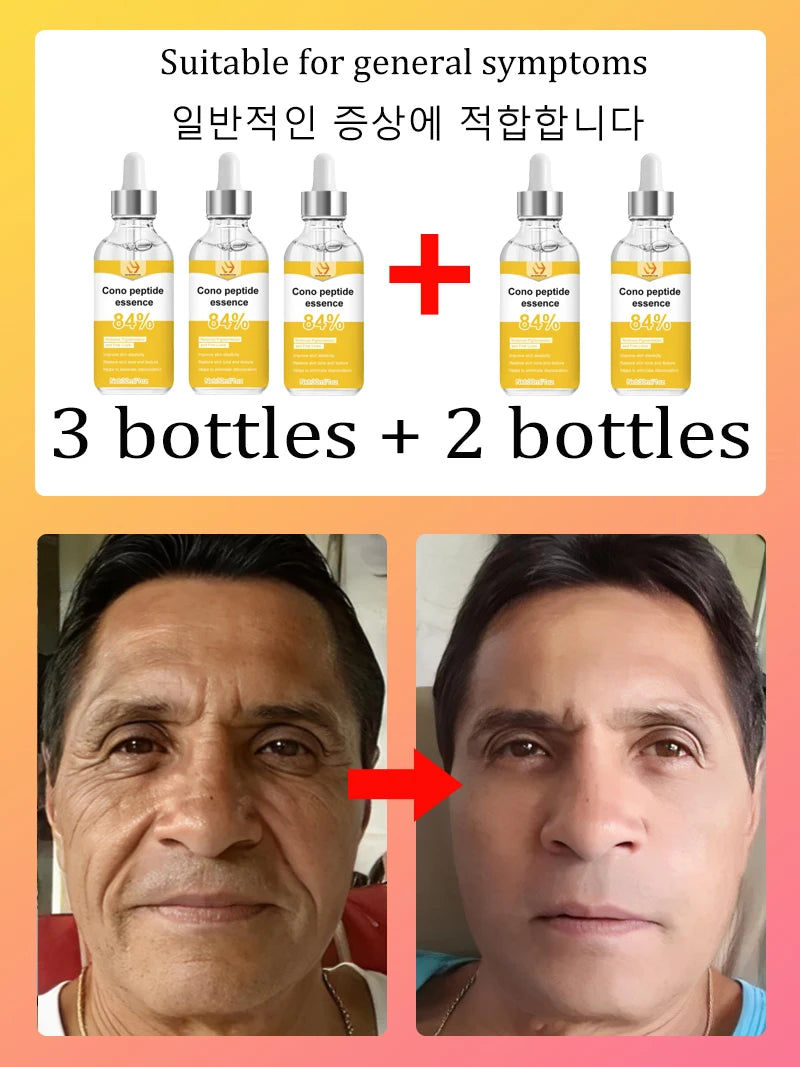 NO Wrinkle, 20 years younger.full body face.More discounts on packages
