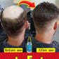 No longer worry about baldness, you will grow thick hair by using this product