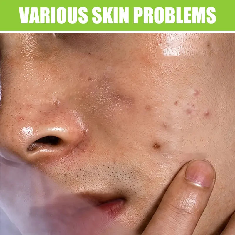 Men's Facial Wash 60g - Green Tea & Salicylic Acid, Deep Cleansing & Oil Control, with Tea Tree Oil & Charcoal, for Oily Skin