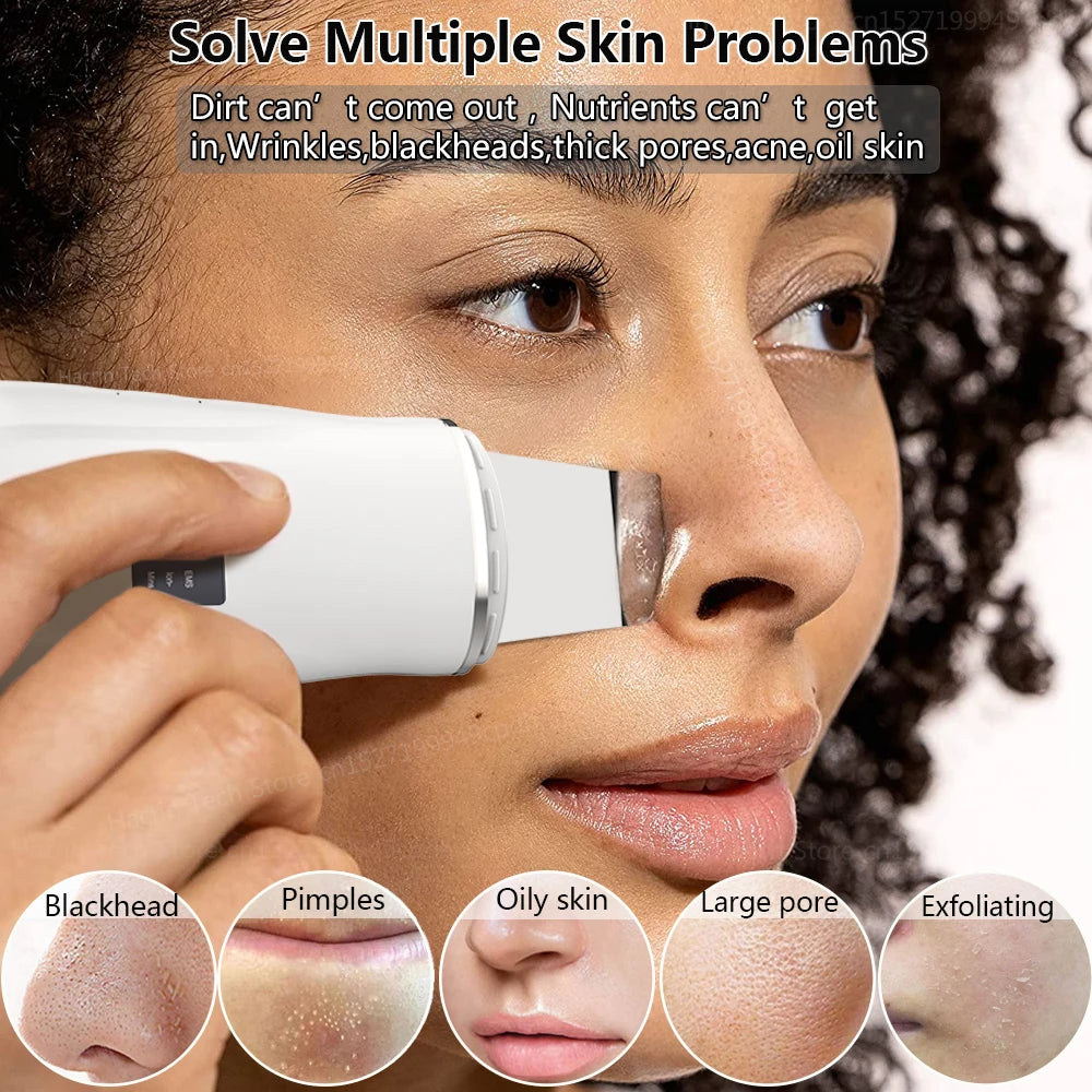 Blackhead Remover Electric Pore Face Cleaner Pimple Acne BlackHead Removal Black Dot Remove Ultrasonic Peeling Remover Blackhead