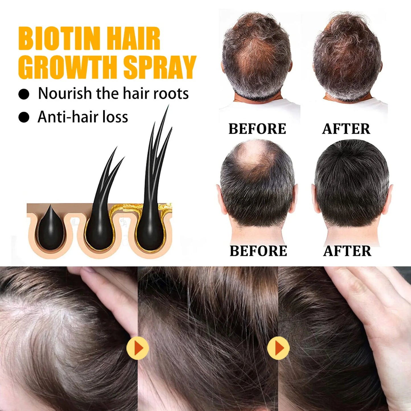EELHOE Biotin Hair Spray For Man Women 30ml Hair Growth Repair Damage Restore Oil Scalp Repair Serum Spray Thicken Hair Care
