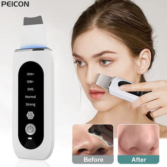 Ultrasonic Skin Scrubber Facial Peeling Face Scrubber Blackhead Remover Ance Pore Deep Facial Cleaning Spatula Facial Cleanser
